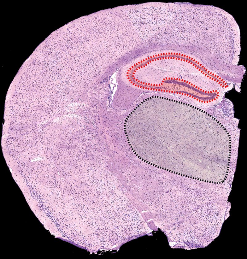 By selecting any two regions you can easily discover the most differentially expressed genes. Read our showcase here: buff.ly/2uhOs03 #Spatial #SpatialTranscriptomics