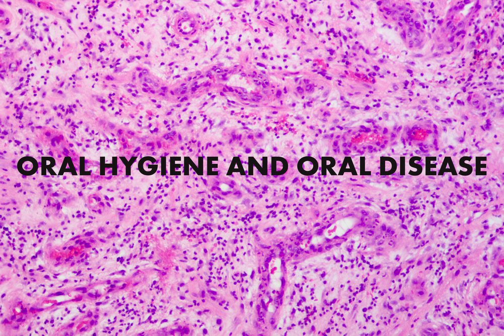 Reminder: August 11, 2018 is the next CE Event to be held at the Hotel Irvine in Irvine, CA.  If you sign up by tomorrow, you will receive a discount.  Hurry...you don't want to miss this great CE Event dhdoa.org/seminars/ #hygienists #Dentists