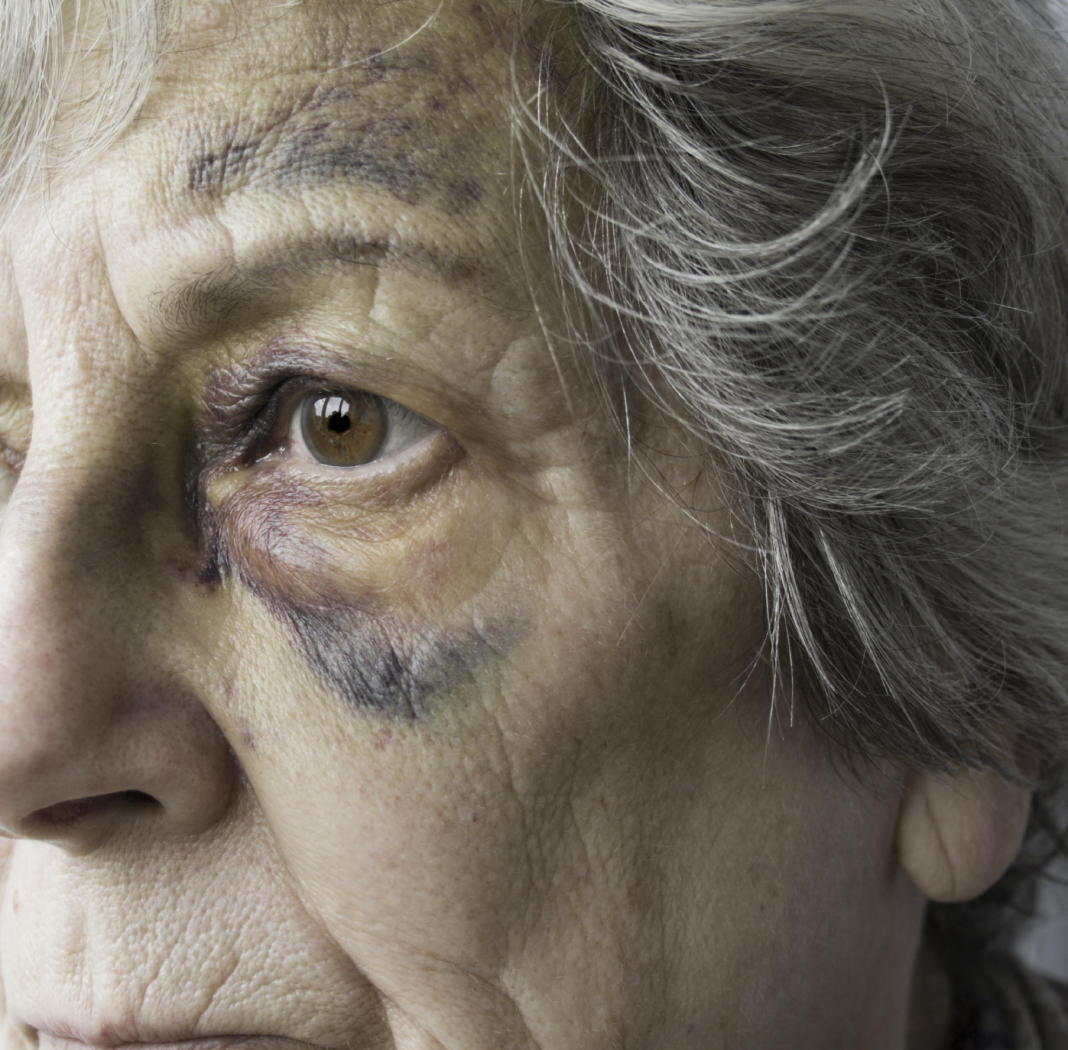 JournalistaLtd's tweet image. Should elder abuse be a hate crime? We and @elderabuseuk think so. Read all about our campaign with @Daily_Express #complexmadeclear #charitycomms #charityPR ow.ly/5Mo030liIdR