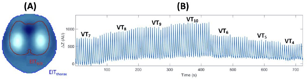 swisstomography's tweet photo. Monitoring of tidal ventilation by electrical impedance tomography in anaesthetised horses @MurdochUniNews 
#Horses  
https://t.co/tmljSM6F59 https://t.co/QWoEoggTpM