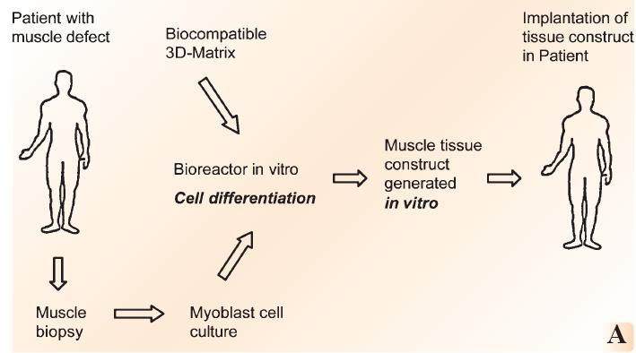 biomaterials019's tweet photo. #Skeletal #Muscle #Tissue #Engineering: Muscle cells are exposed to #mechanical force in order to organize #mononucleated #myoblasts into #parallel, #multinucleated #myofibers, match #bone and #muscle #growth rate to know more visit: https://t.co/wbZodLB8aO #AdvancedBiomaterials https://t.co/u9DPdemLSn