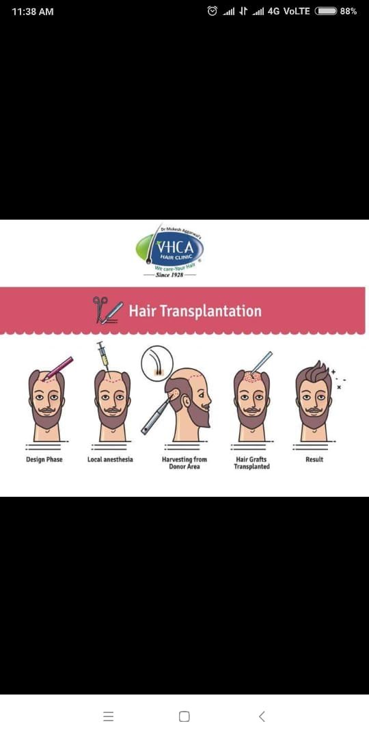 VHCA Hair Clinic (@VhcaC) / Twitter VHCA Hair Clinic (@VhcaC) / Twitter
