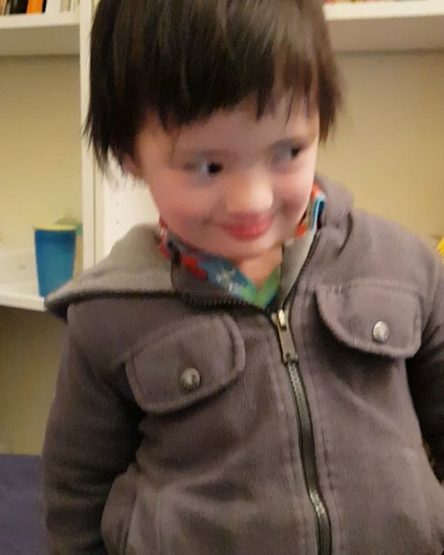 jackiemsydney's tweet photo. This is apparently how baby Noah brushes his teeth, as learned from watching Barney and Friends.
https://t.co/yET8zEXKXC
#babyNoah #DownSyndrome #dsdn #hydrops #AVSD #duodenalatresia #NICU #PICU #jackiemlife #T21 #DownSyndromeAwareness #DownSyndromeHero #LifeWithDS #Disabi… https://t.co/EXowvbXSQy