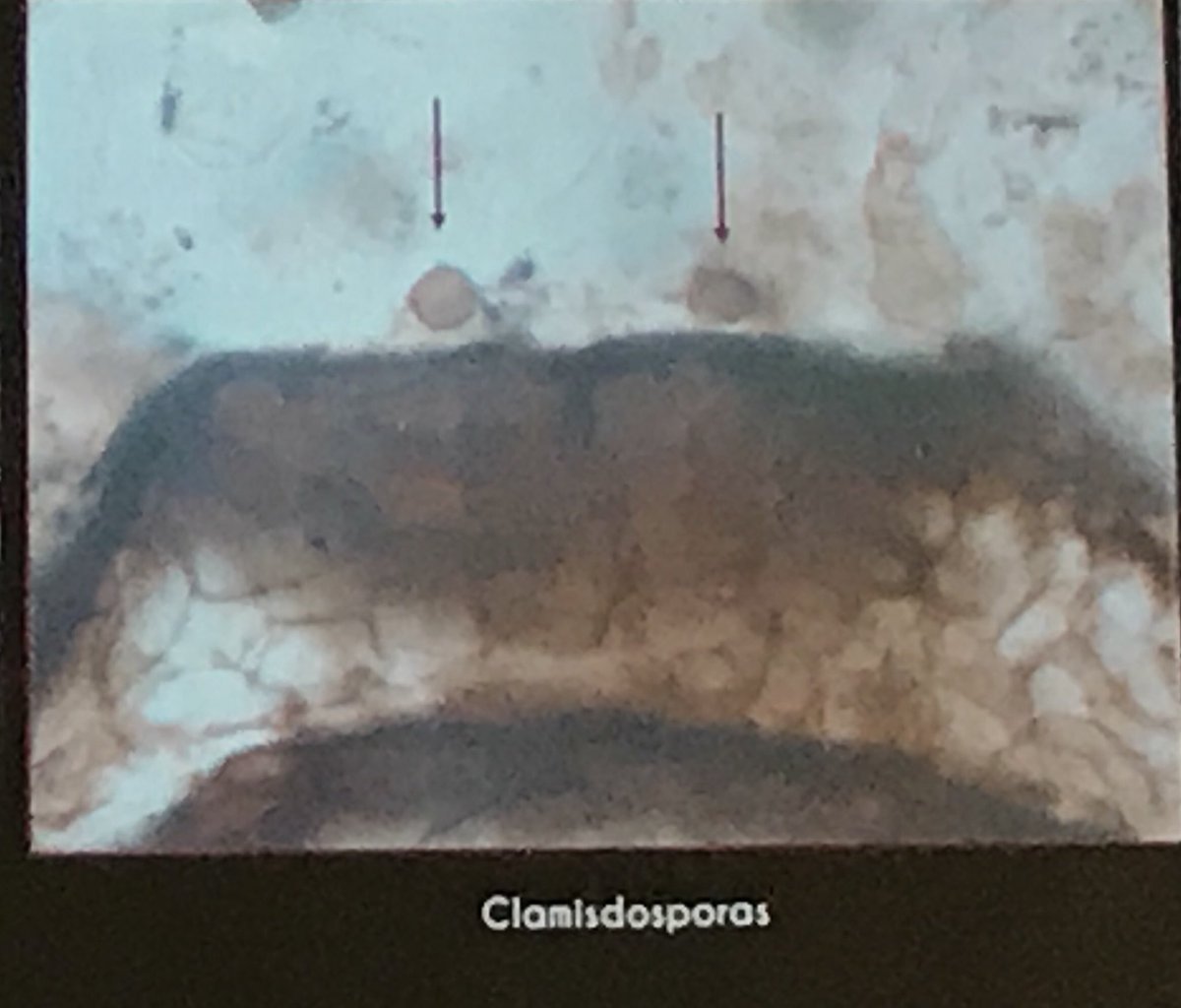 PalyJen's tweet photo. On to my ❤️❤️, with mycorrhizae! Gorgeous photos of ectomycorrhizal associations in gymnospermous roots from Jurassic chert. Check out those chlamydospores! #SAPP2018 https://t.co/ePIfICgmHB