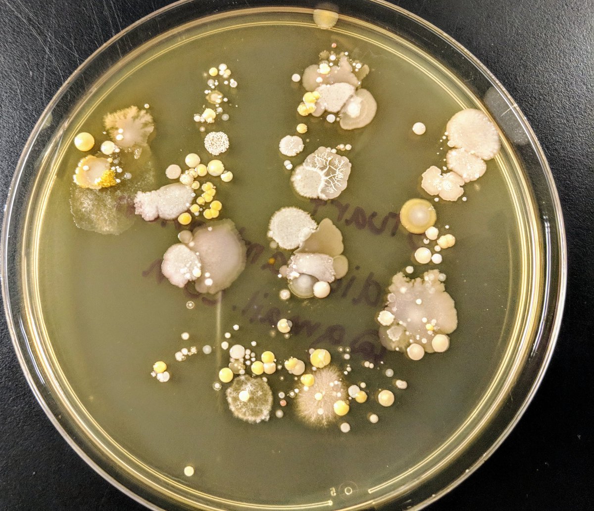 BUGSSlab's tweet photo. Didya wash your hands before dinner? π #microbiome #skinmicrobes #microbiology #communityscience #agarart #sciart #nonprofit #baltimore #artscape2018 #bioart #scienceforall https://t.co/U2Piw6s9bz