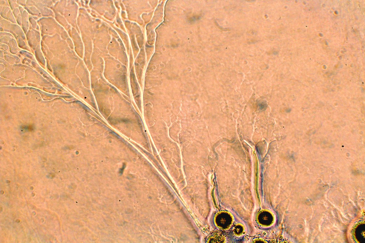 musicalmicrobe's tweet photo. Spotted this extra large #chytrid #fungus in one of my cultures. How is it so big? Like tall trees competing for light, the fungus on the left may have had to have grown past the rest to get its nutrients.
#MResMBIO #Mycology #Microbiology https://t.co/ihXZWTO5E2
