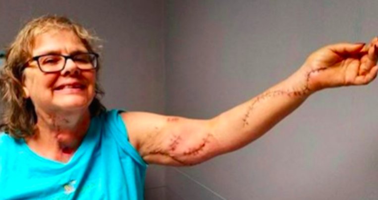 Attacked In The ER - One nurses story of survival, and how she continues to plead for hospital security law ht.ly/8gh530lcdWt #patientviolence #endnurseabuse