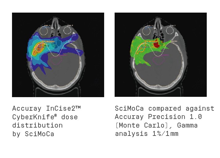 shop human atheroma with particular reference to