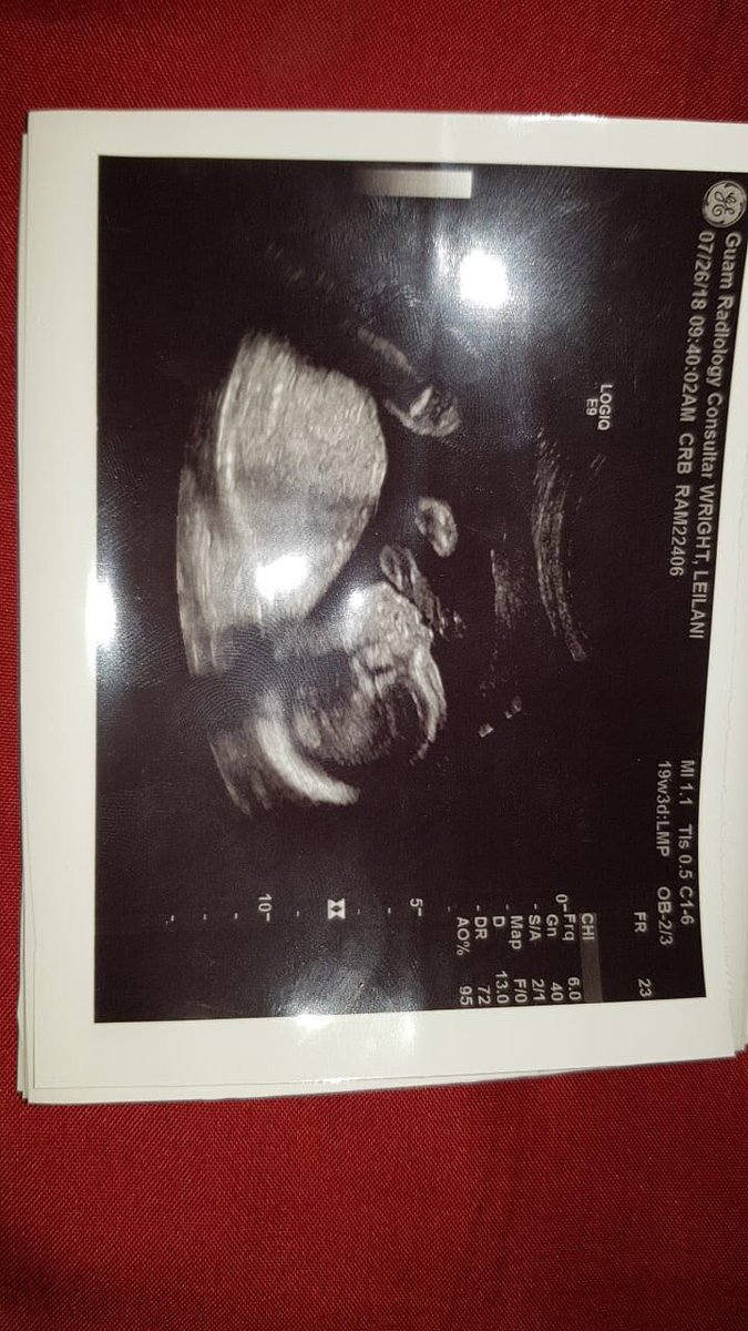 wrightousss's tweet photo. everyday is another day closer to meeting you my baby , I can’t wait !!!🤰🏻🤱🏻💙 #biggestblessing✨ https://t.co/x8jHh8mVsY
