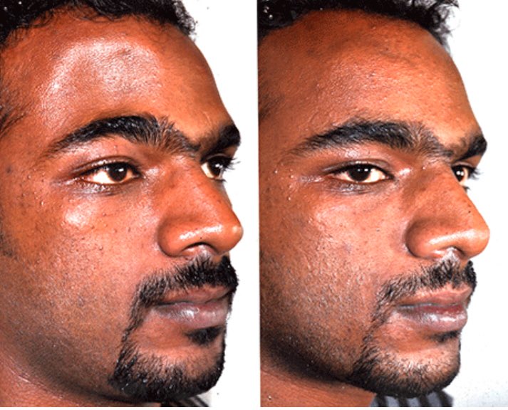 facial-deformities-photos-jean-short-shorts-pussy