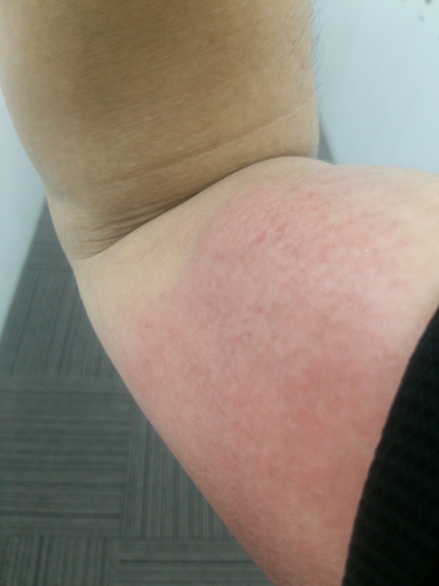 Toshi4702 Ar Twitter 股ずれならぬ脇ズレ 地味に辛いです