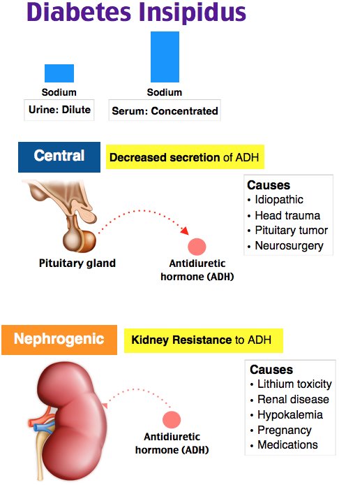 nephrogenic vs central diabetes insipidus