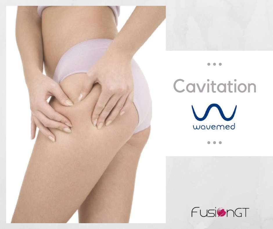 FusionGtUk's tweet photo. More than #cavitation: #Wavemed goes beyond! With 2 types of energy delivery, either continuous or pulsed, Venus can address the issue of #bodyfat more completely. Its modular concept will allow you to combine cavitation & radio frequency https://t.co/fdWCaDuHbO #aesthetics https://t.co/DBU6QQ5zCg