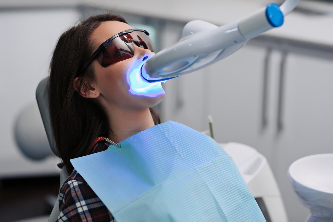 отбеливание зубов doctor smile