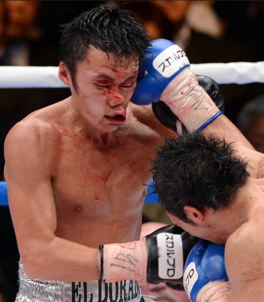 Diario As Enis Pacheco Vs Duda Yankovich T Co Vu2kcj6vyb