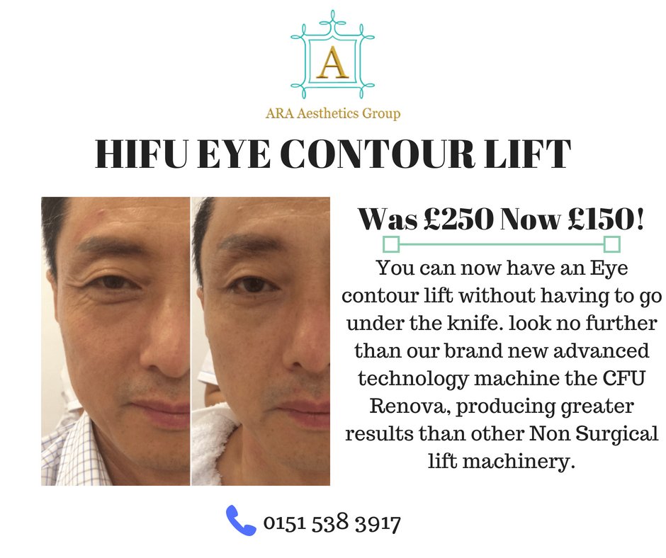 alluremedispaL3's tweet photo. HIFU RENOVA Non Surgical Eye Contour Lift
Was £250 now £150!
Full eye contour Lift which includes eyebrow lift and forehead.

Click on this link below to get this offer now 👇
https://t.co/s8wfLZU1cS https://t.co/lNvISLvOfQ