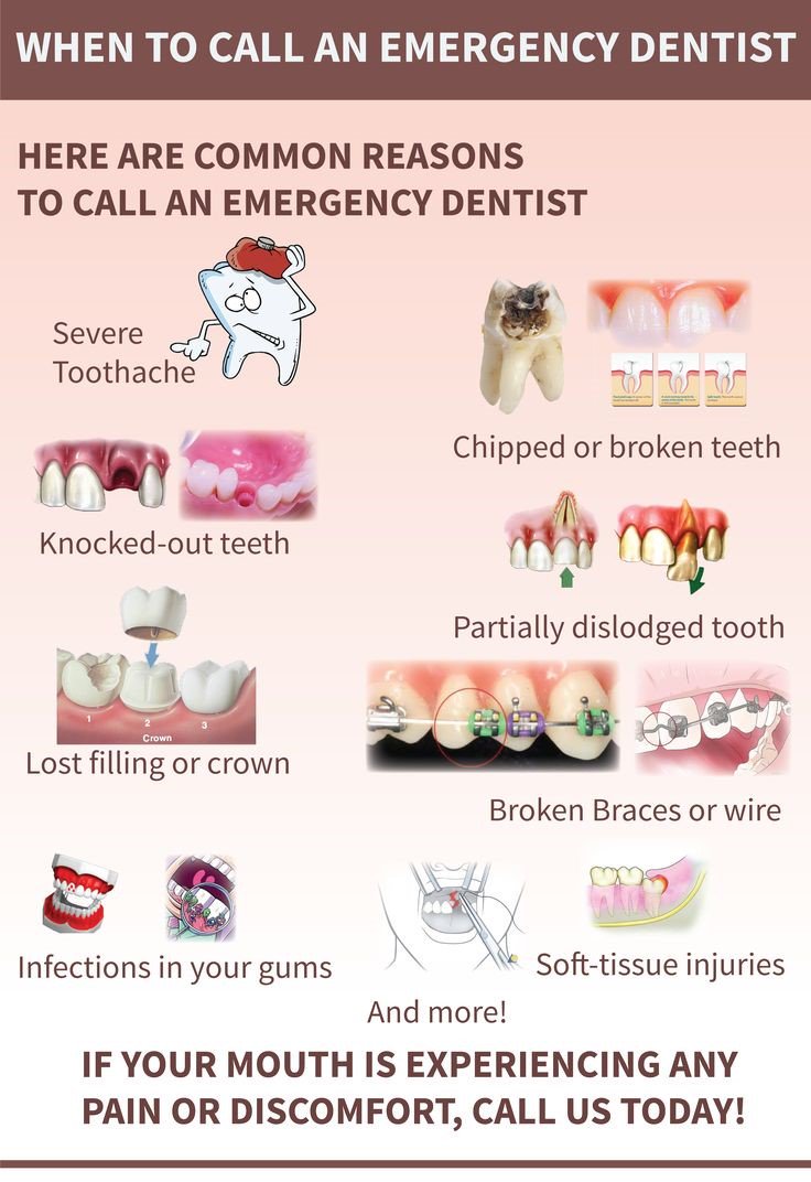 DARRDentistry's tweet photo. Dental emergencies are quite frightening and often painful.  Prompt treatment is almost always required to alleviate pain and to ensure the teeth have the best possible chance of survival.
https://t.co/LEj6XEIVD5 https://t.co/3ZUuFlmf6i