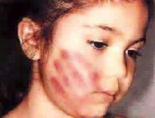 murshed_awan's tweet photo. وہ برتن مانجھ آئی مگر گالوں نے بتلایا !! 
کہ برتن کانچ کا اس سے کوئی پھر آج ٹوٹا ہے
#stopchildmarriages 
#StopChildabusing
@DrAyeshaNaveed @mariamsmadness @khan_ki_PTI @sadafnawaid https://t.co/T9l7P0BY7U