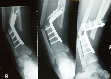 #TrafficTIp : please keep your feet off the dash in your vehicle....  airbags are deployed @ 160kph- 340kph &amp; ram whatever is in their way into your face, the side window or the driver.  #roadsafety #trafficsafety #police #AbbyPDTEU #Abbotsford  #drivesafe