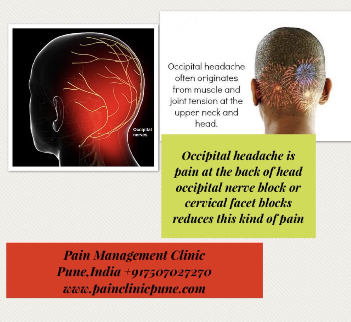 Occipital neuralgia ,pain usually at the back of the head may be in upper part of the neck #headaches #occipitalneuralgia #ChronicPain #painrelief #painmanagement #painclinic #pune #india #bestpaindoctor #paintreatment #painclinicpune    Pain Management Clinic,+917507027270