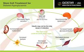 Res_Allergy's tweet photo. Stem Cell Therapy for Diabetes https://t.co/9V1XCTrdZM