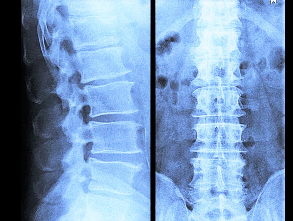 Imaging – Does it actually paint a clearer picture? motionmn.com/imaging-does-i…