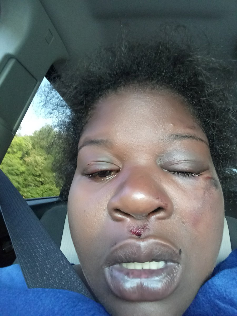 cocoadray's tweet image. This is the face of a woman who husband after twenty years of being together ten years of marriage looks like. Heleft me unconscious in a ditch in New Jersey.  Oh did I  mention it was my BIRTHDAY 🍾🍾🍾#GODHASABETTERPLANFORME