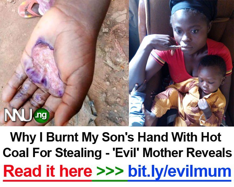 NNU_Income - Why I Burnt My Son's Hand With Hot Coal For Stealing - 'Evil' Mother Reveals (Photos) >>> bit.ly/evilmum