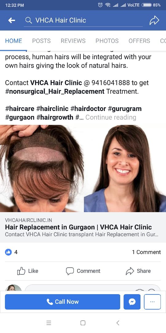 VHCA Hair Clinic on Twitter: VHCA Hair Clinic on Twitter:
