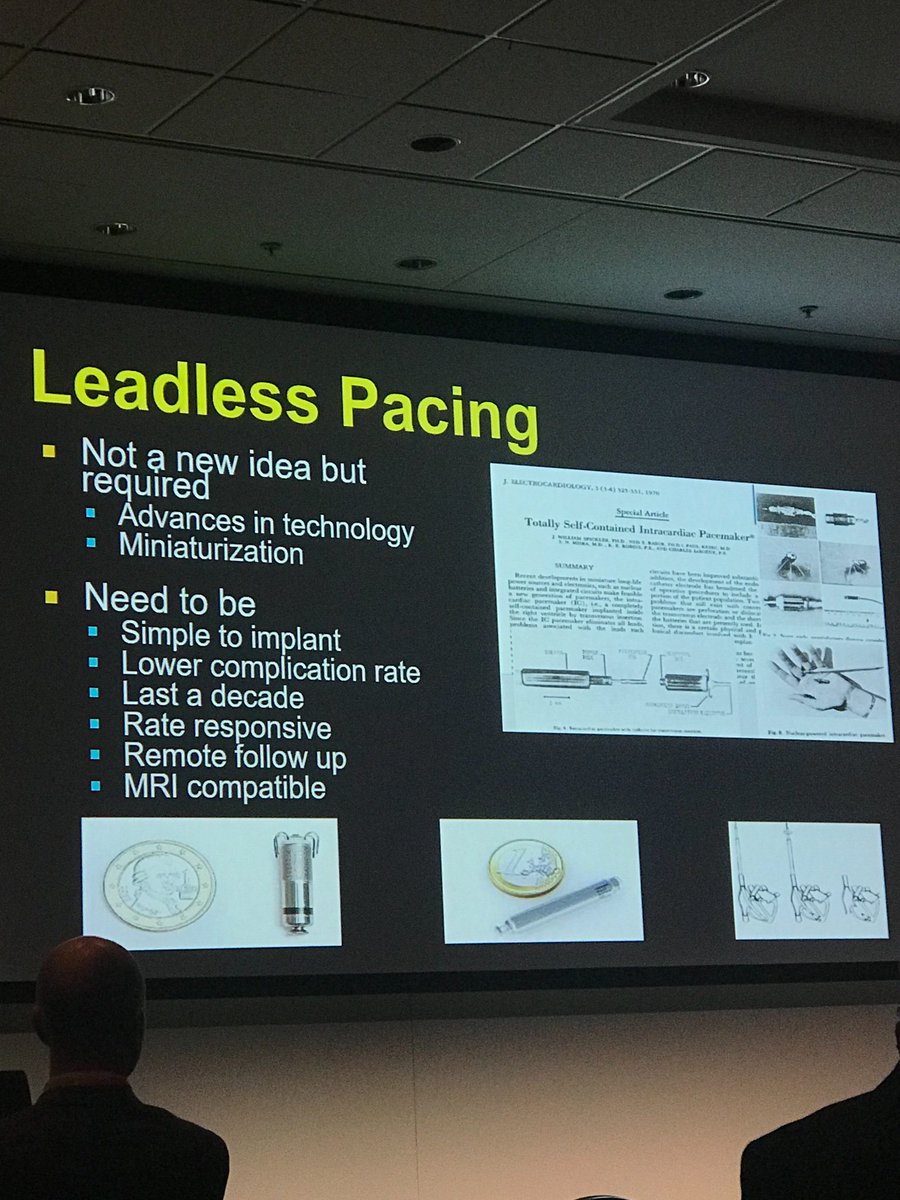 olynganzon's tweet photo. Leadless pacing @ThomsonMangnall @thecsanz #csanz2018 https://t.co/ELz0wdh9w7