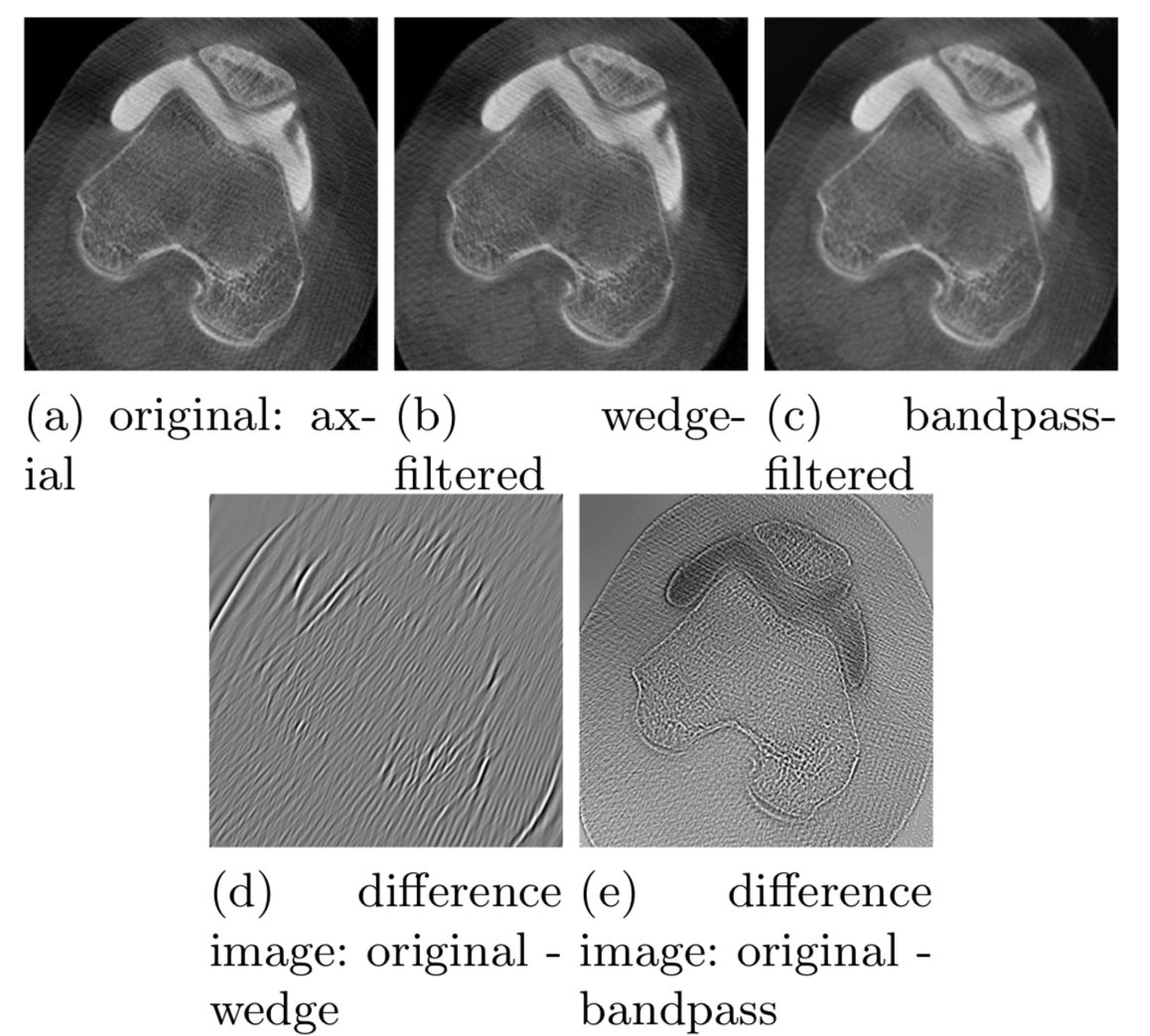 maier_ak's tweet photo. Can we use prior knowledge to suppress directional cone-beam artefacts? Look at this nice paper by Julia for some promising first results: https://t.co/4Zx2Nw2n6H @FAU_Germany @BVM_Community #radiology #nodeeplearning #medicalimaging https://t.co/AaF2k2RUQS