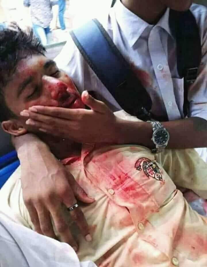 wp_zaman's tweet photo. Situation is worsening. Govt. is trying to hide their illegal attack on innocent students. 4 people died, girls were raped. Please help us #Roadsafety #WeWantJustice @BBCWorld @AlJazeera @CNN https://t.co/gFRqZUsNEZ