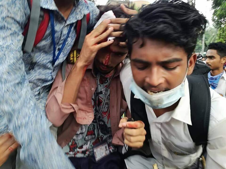 beingsaifur's tweet photo. Students in Bangladesh are being attacked, murdered, and r* for standing up against their government. They have now had their wifi cut-off to prevent the news from spreading around. Please do not silence them. #WeWantJustice https://t.co/b1CpACqkh4