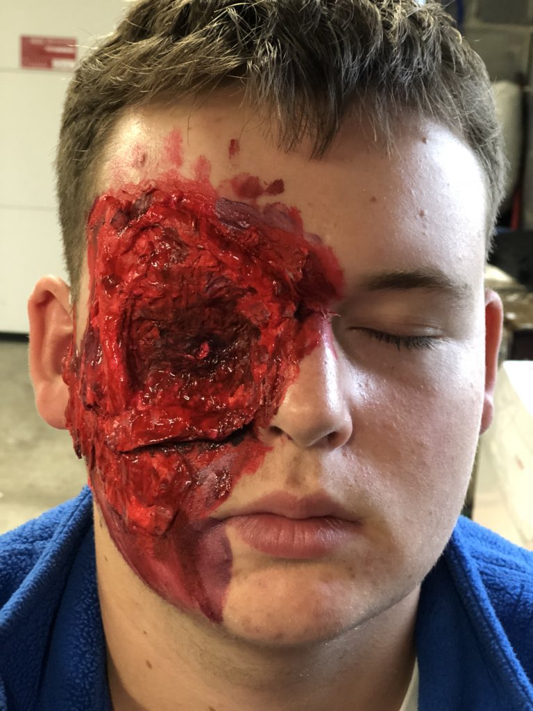 AAdam_twd's tweet photo. Did some makeup the other day for a short film #newnations #makeup #specialeffects #latex #zombie #carlgrimes #missingeye https://t.co/x8laDPjP4g