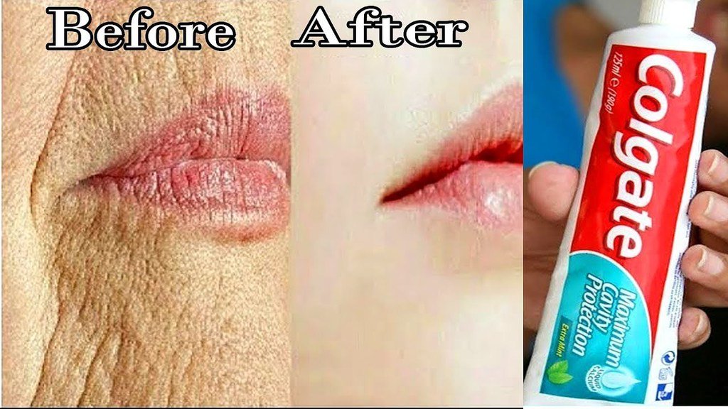 healthandbw's tweet image. youtu.be/5W39vvcFOmA Apply Toothpaste on Your Skin and See the Magical Result in 1 Night | Toothpaste for Anti Aging


#toothpastebeautyhacks #toothpastehacks #toothpastetricks

Reducing Wrinkles
Toothpaste For Dark Lines 
Too… ift.tt/2l0Jouu