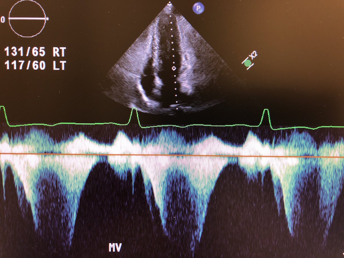 ucsf echo ucsf echo twitter