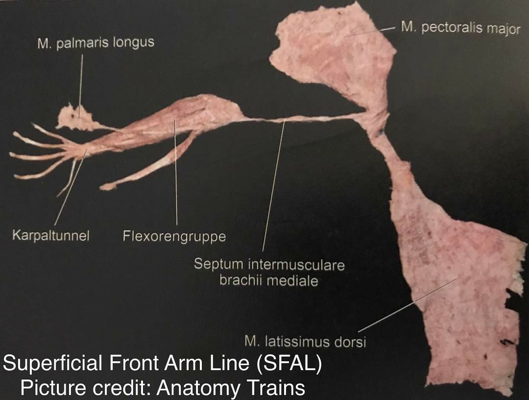 📌Supoerficial Front Arm Line📌
@AnatomyTrains 'in kurucusu Thomas Myers'in teorik düşüncesini kanıtlamak için yaptığı kadavra çalışmasında latissimus dorsi ve pektoralis major'ün fleksör grup, palmaris longus ve karpal tüneli de içine alan bağlantılarını görebilirsiniz.