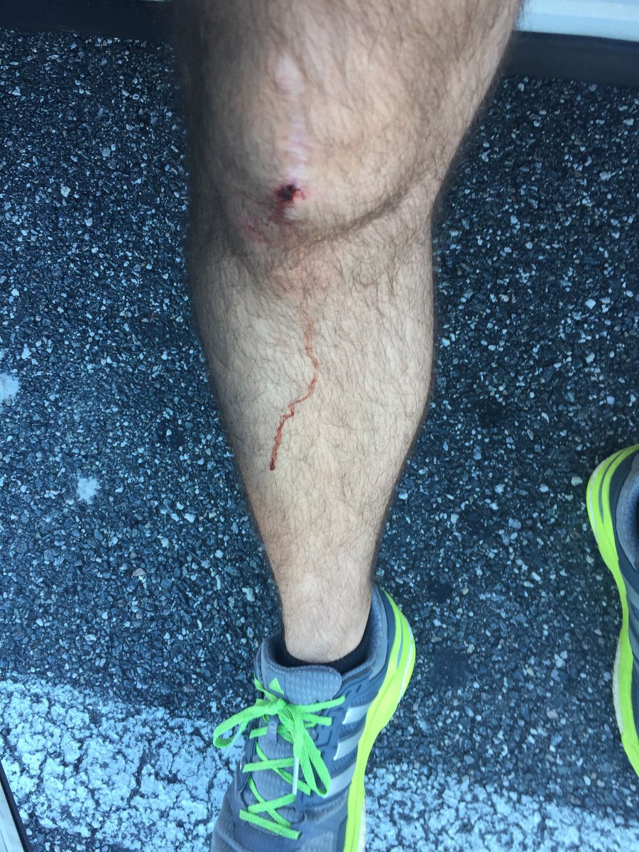 marathondads's tweet photo. Almost passed out and actually fell/tripped on the road. Had to be lifted off the ground but I still finished. 

Never ever give up!  God bless the fellow runners who came to my aid! https://t.co/qDWydaNUJL