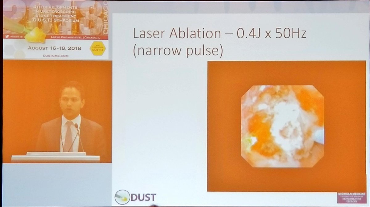 vourganti's tweet photo. Another perk of living in Chicago for the esoteric Urology Nerd: Enjoying the excellent #DUST18 conference, and learning the merits of various laser settings for optimal destruction of urothelial cancer (just did this for a pt with #lynchsyndrome). @peepeeDoctor https://t.co/mlwlSmkYjW