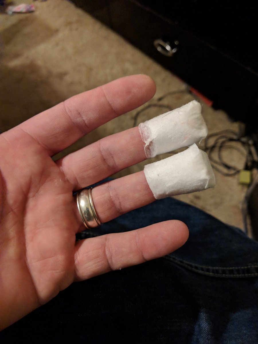 VintageJerm's tweet photo. If I could only say this was a #Fortnite related injury using the left handed #PS4 controller. 2 seasons in still #Freeplaying https://t.co/s9RDaHKGhQ