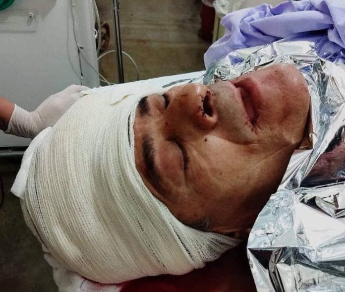 webnotitarde's tweet image. #18Agos Venezolanos le dieron una paliza a comerciante en #Pacaraima (+Video) #Sucesos 

goo.gl/MjhhrV