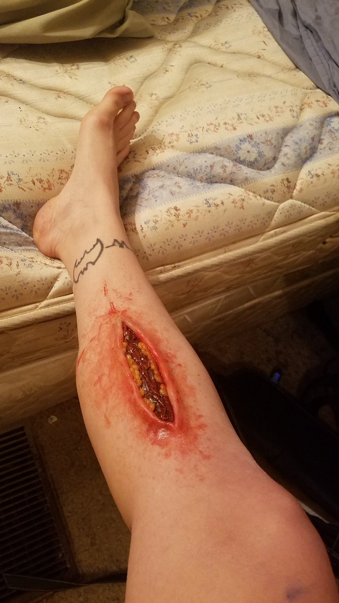 Crystal2Chaotic's tweet photo. #shatterfxandphotography #gash #silicone #scarwax #surgicalcuts #cleanwound #fxmakup #CrystalLarson #realisticwounds #cuts #deepcuts #bloody #halloween #haunters #actors #scary #horror #sfxmakeup #cosplay #tragedy4ever #ShatteredFears #shatter https://t.co/mctQrgZtsR