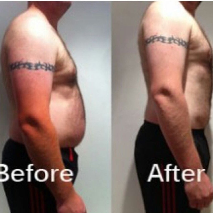 TechnoshapeA's tweet image. Check out the fantastic results of #TechnoShape program in just 4 weeks and the client satisfied with the result 
#styleyourbody#getinshape#befit#fitnessmotivation#inchloss#slimmerstomach#happy
