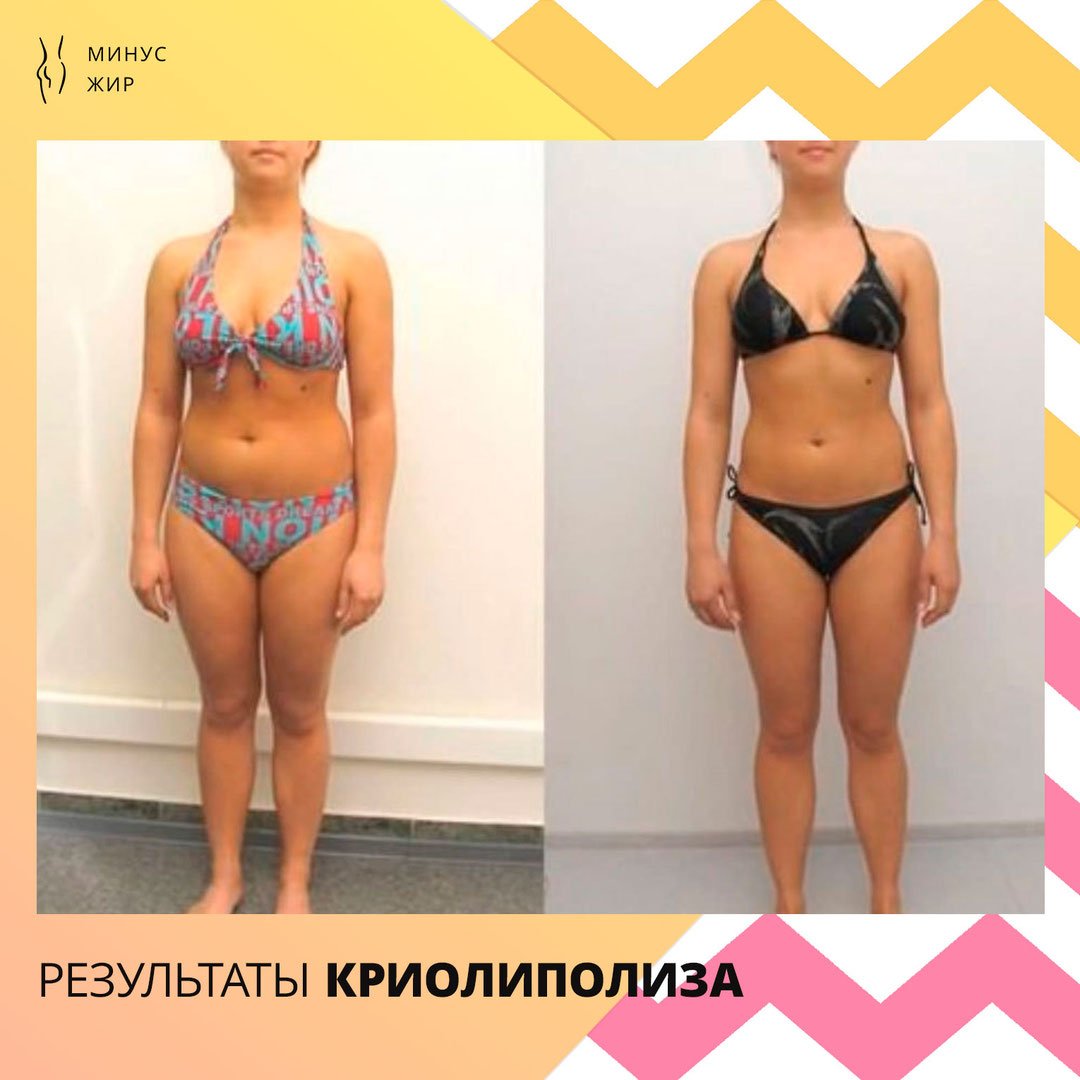 Арбузная Диета Результат В Кг.