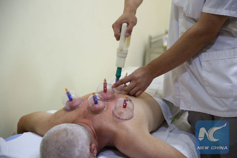 XHNews's tweet image. When you are sick, have you ever thought about seeing a traditional #Chinese doctor? Wanna try acupuncture or cup #therapy? xhne.ws/3eBzv