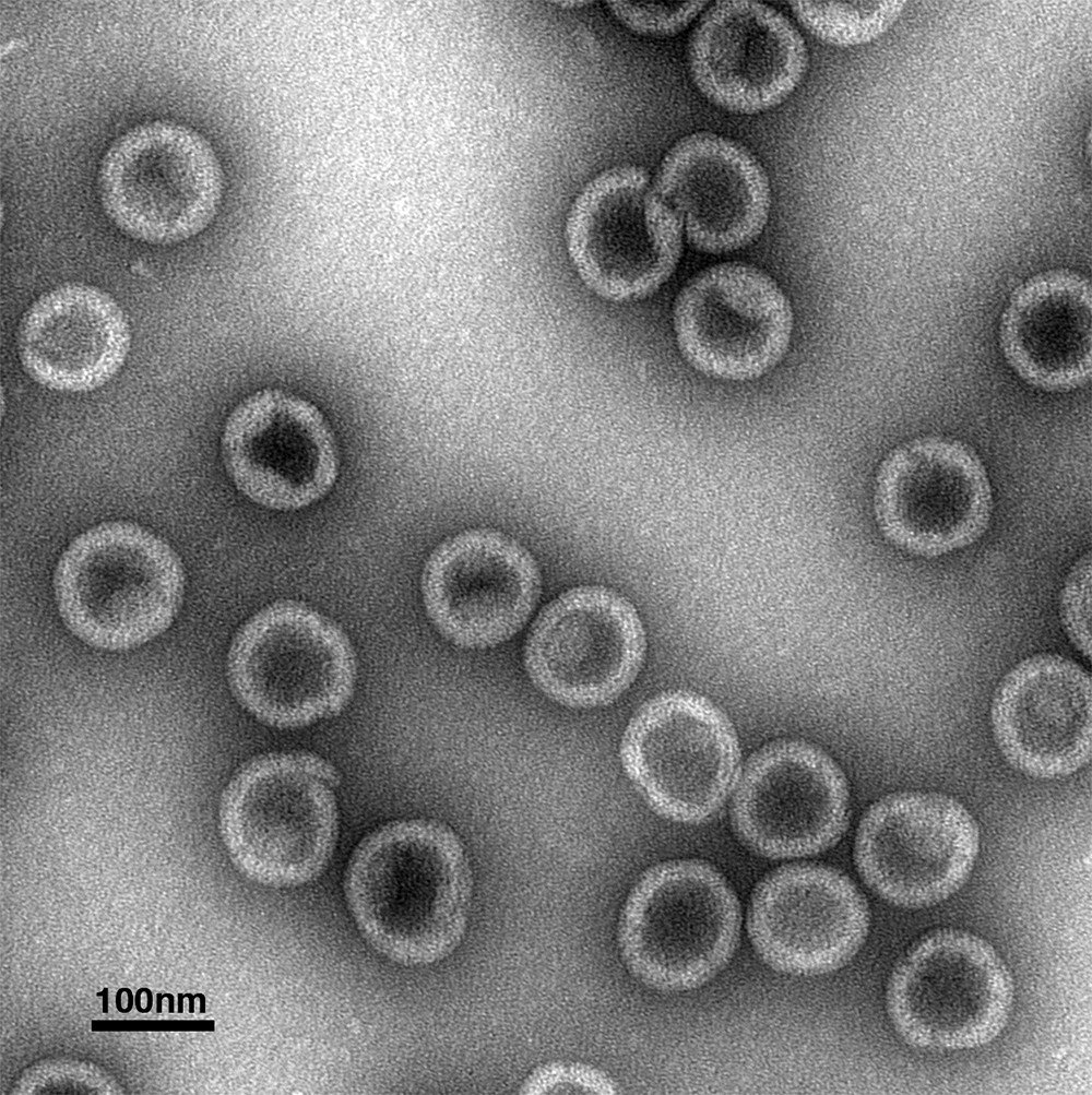 Research <a href="/CornellCALS/">Cornell CALS</a> provides details of how the structure of the HIV-1 virus is assembled, offering potential new targets for treatment. news.cornell.edu/stories/2018/0…