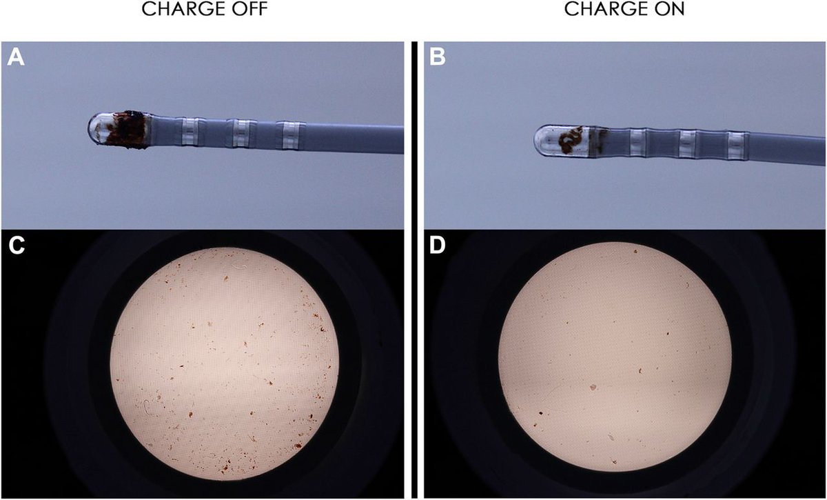 JACCJournals's tweet image. Effect of Charge Delivery on Thromboembolism during Radiofrequency Ablation in Canines. #JACCCEP #thromboembolic buff.ly/2Kzf82M