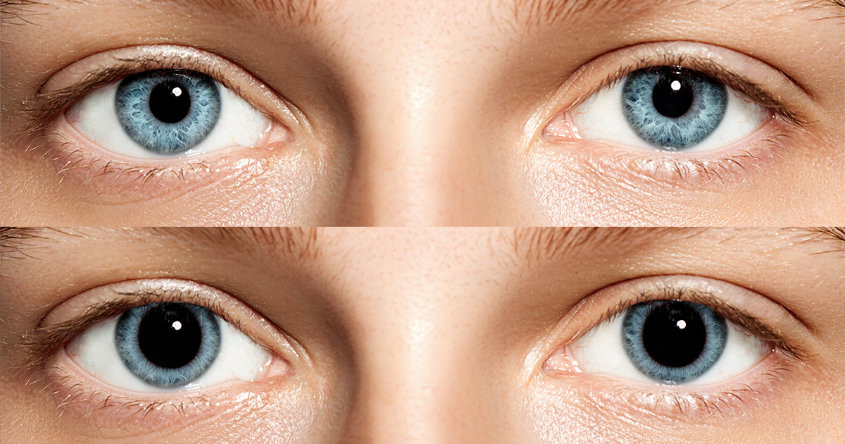 Langtonopt's tweet image. Dilated Pupils: Causes and Concerns dlvr.it/Qf7hHW