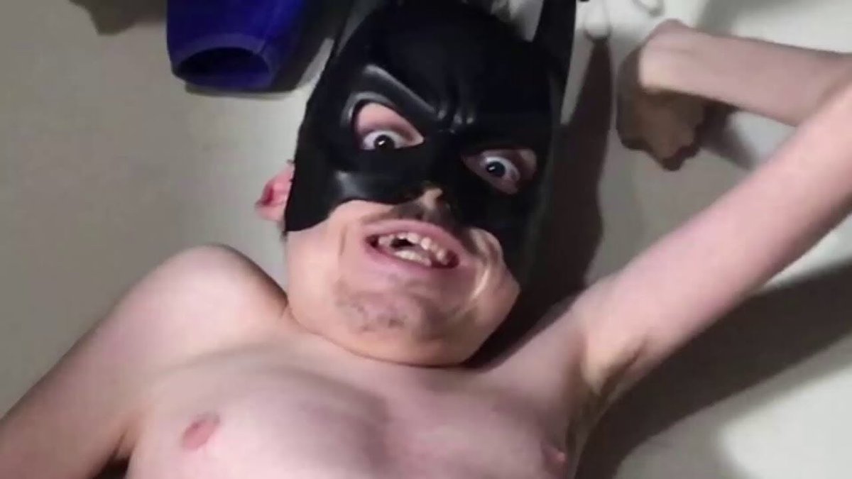 Whats wrong with ricky berwick