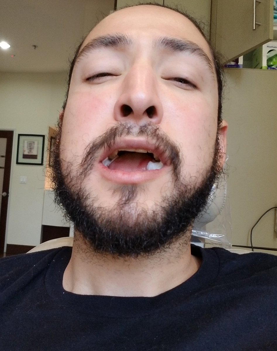 uberhaxornova james